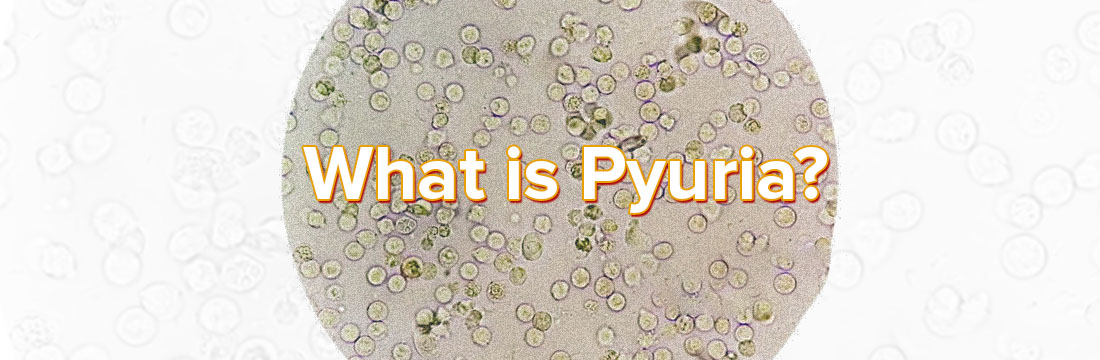 What Is Pyuria